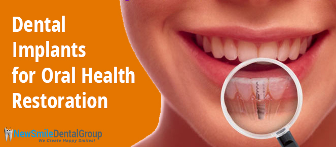 Dental Implants for Oral Health Restoration