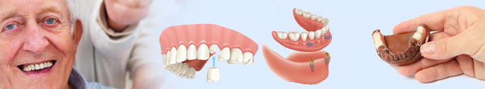 Dentures-innerbanner